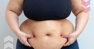 How Low Estrogen Post-Menopause Shifts Fat Storage to the Abdomen in Women x