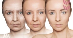 The Role of Age in Women: Why Metabolism Slows with Aging x