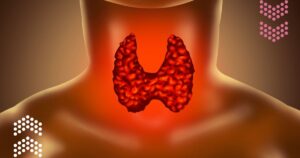 Thyroid Function and Weight in Women x
